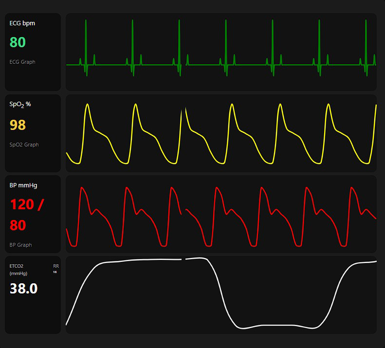 Vitals